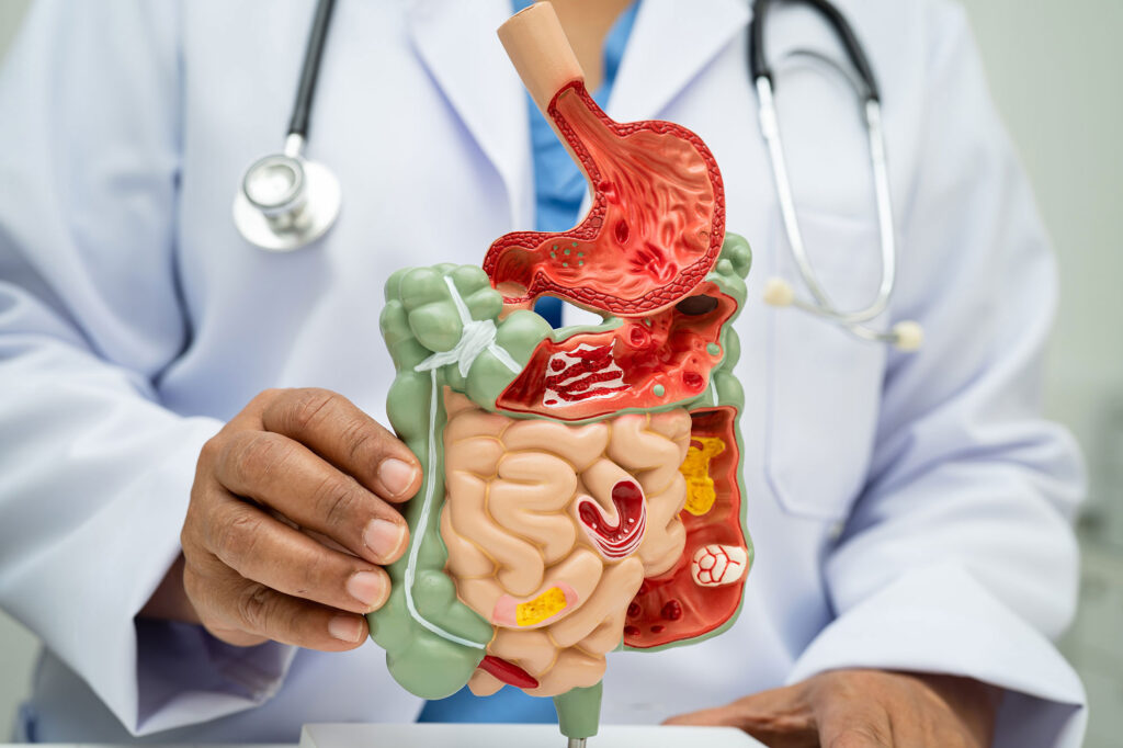 Tele gastroenterology